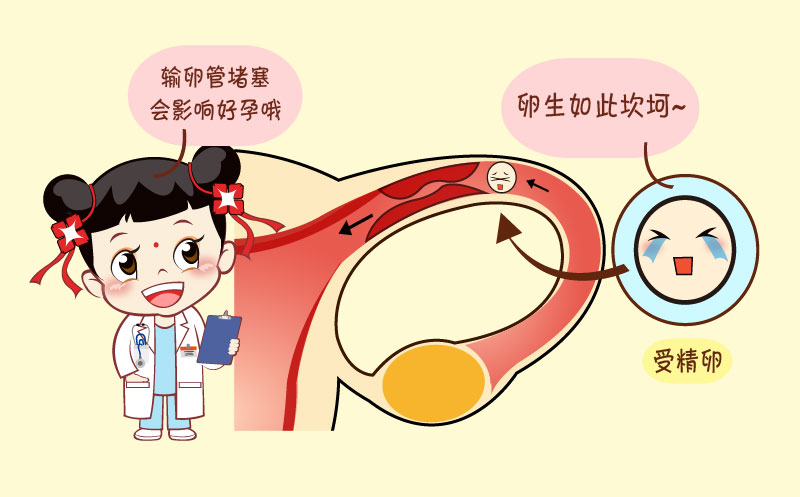 夫妻血液排斥不孕怎么辦,夫妻血液排斥導(dǎo)致不孕，綜合性計劃評估與應(yīng)對策略,安全性執(zhí)行策略_版刺58.45.57