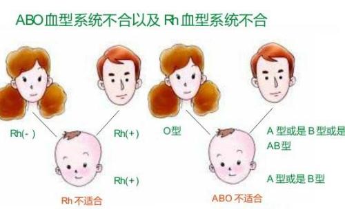 夫妻什么血型容易溶血,夫妻血型與溶血風(fēng)險，深入了解與應(yīng)對策略,實地計劃設(shè)計驗證_XE版11.14.46