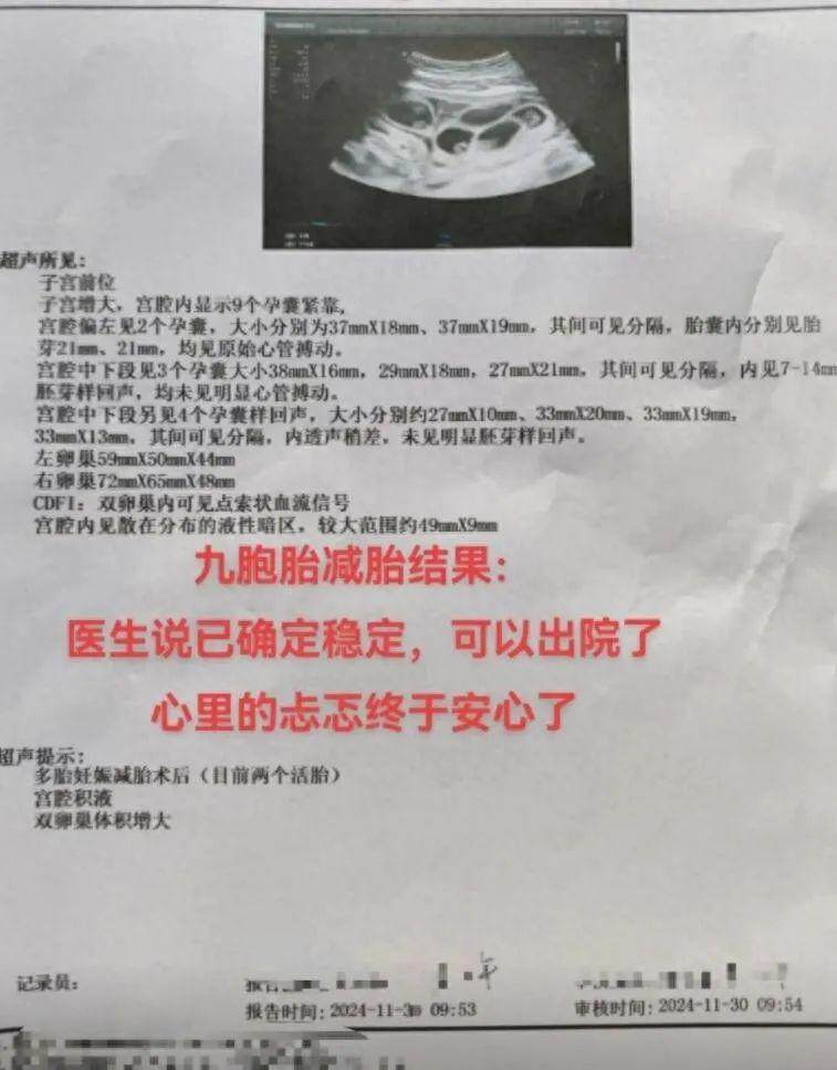 懷9胎女子最后兩胎沒保住